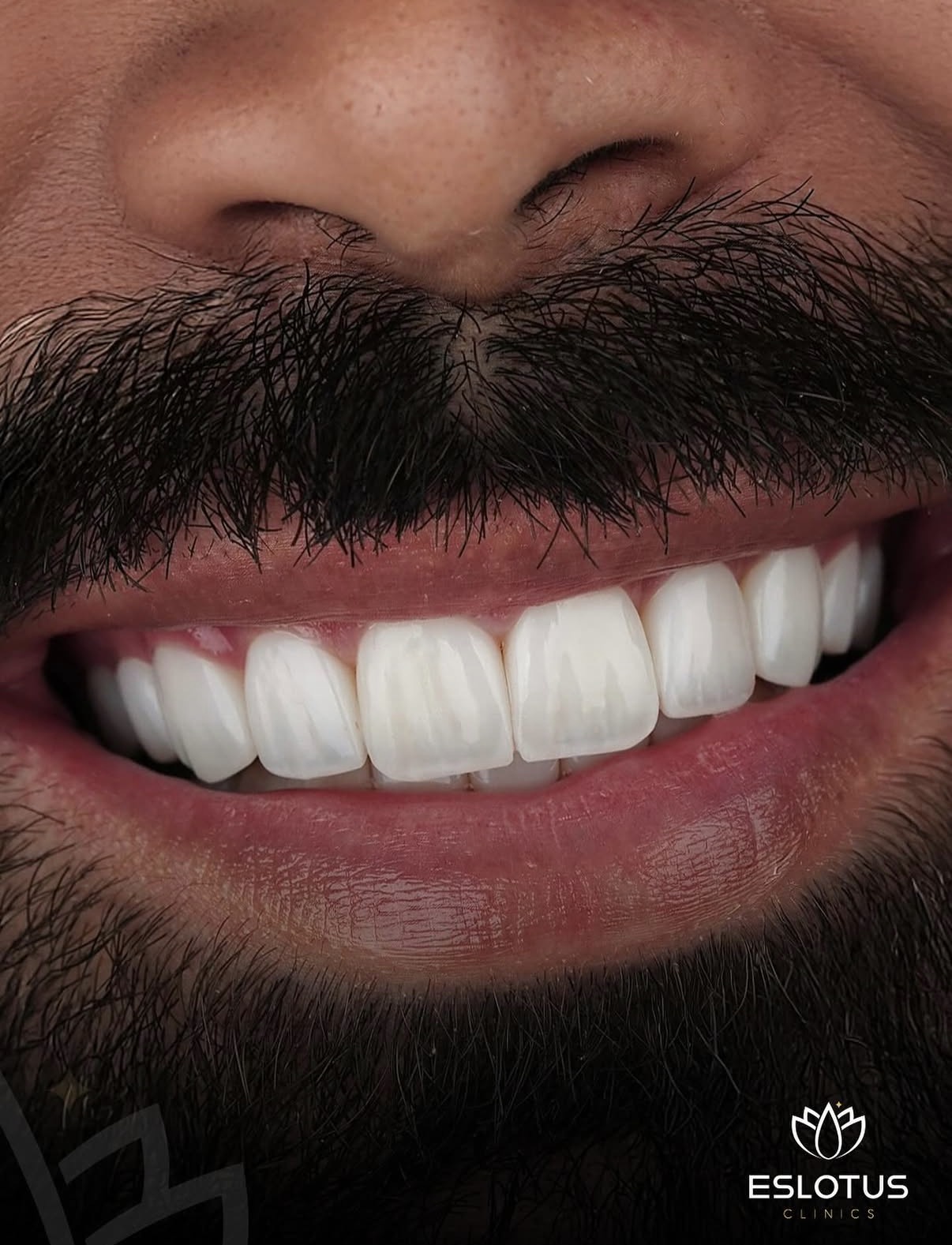 Resultado, Facetas